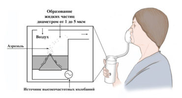 Rules for using an inhaler: how it works and why?